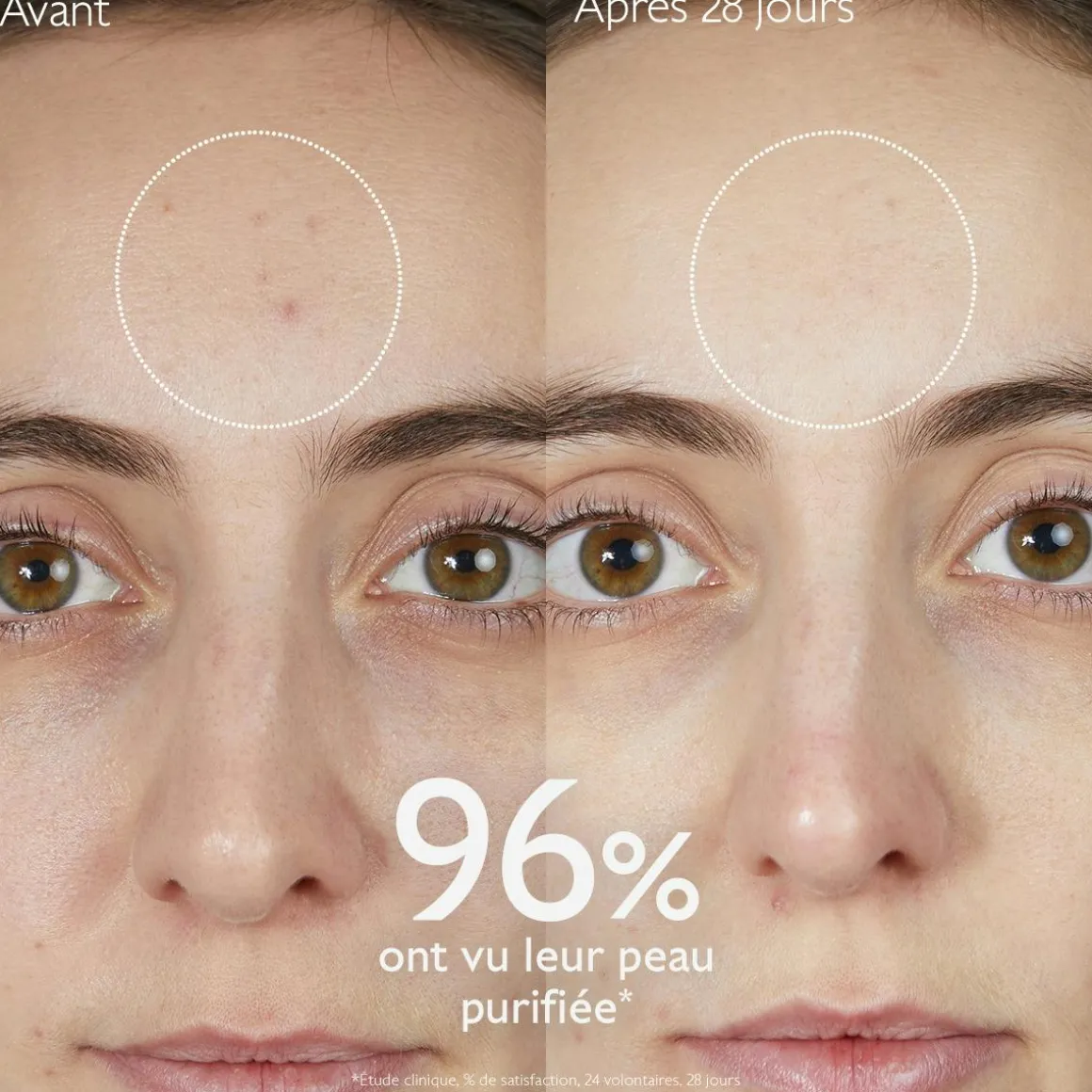 Gelée Nettoyante à l'Acide Salicylique Purifiante - 385mL