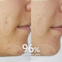 Gelée Nettoyante à l'Acide Salicylique Purifiante - 385mL