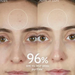 Gelée Nettoyante à l'Acide Salicylique Purifiante - 150mL