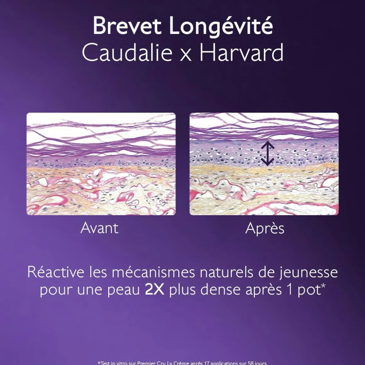 La Crème au Brevet Longévité & filler repulpant naturel
