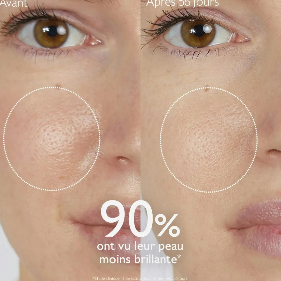 Lotion Purifiante à l'Acide Salicylique - 200mL