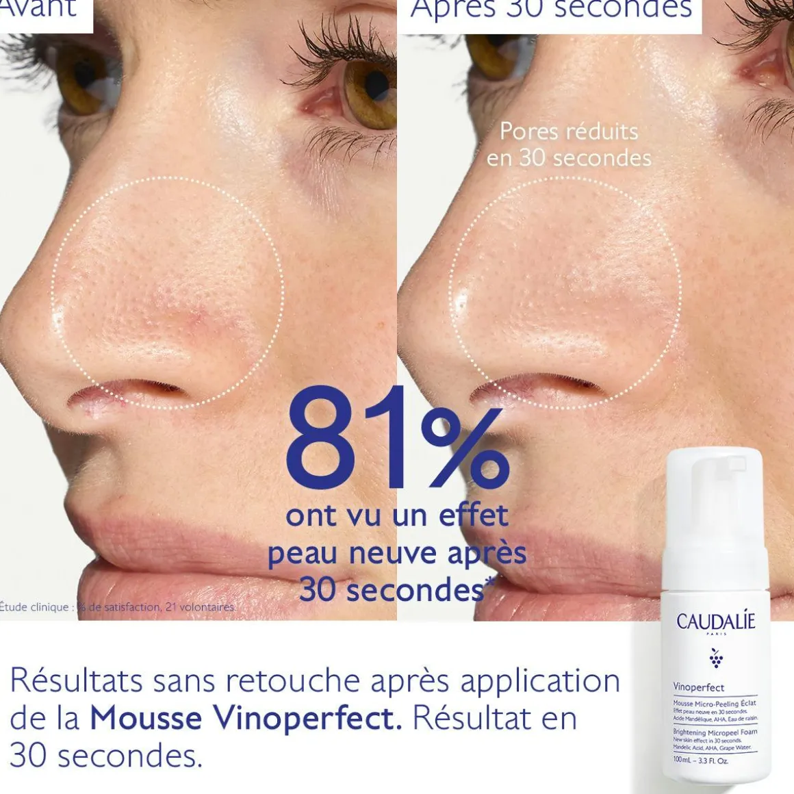 Mousse Micro-Peeling Éclat à l'Acide Mandélique (AHA) - 50mL