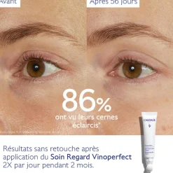 Soin Éclaircissant Regard Anti-Cernes à la Caféine et Niacinamide