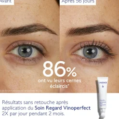 Soin Éclaircissant Regard Anti-Cernes à la Caféine et Niacinamide