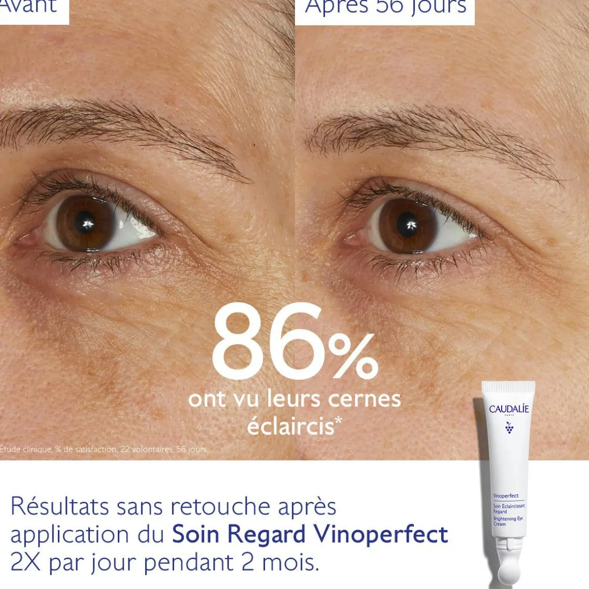 Soin Éclaircissant Regard Anti-Cernes à la Caféine et Niacinamide