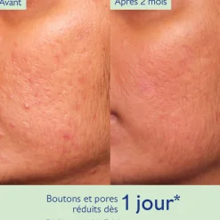 Sérum à l'Acide Salicylique Anti-imperfections