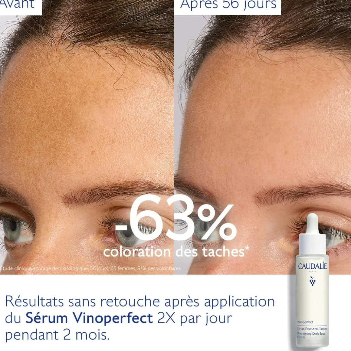 Sérum Éclat Anti-Taches à la Viniférine, alternative à la Vitamine C - Grand Format