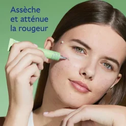 Stop Boutons Salicylique l'Acide Salicylique